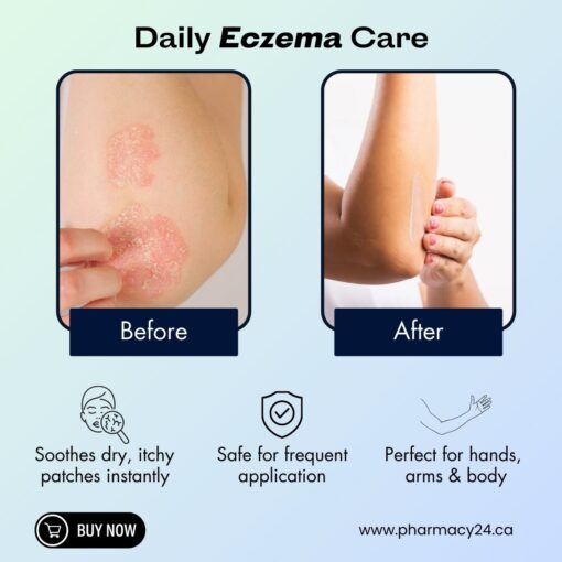 Polysporin Eczema Essentials Cream purchase now