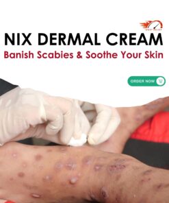 Nix Dermal Cream 30g buy online