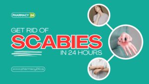 How to Get Rid of Scabies in 24 HoursHow to Get Rid of Scabies in 24 Hours